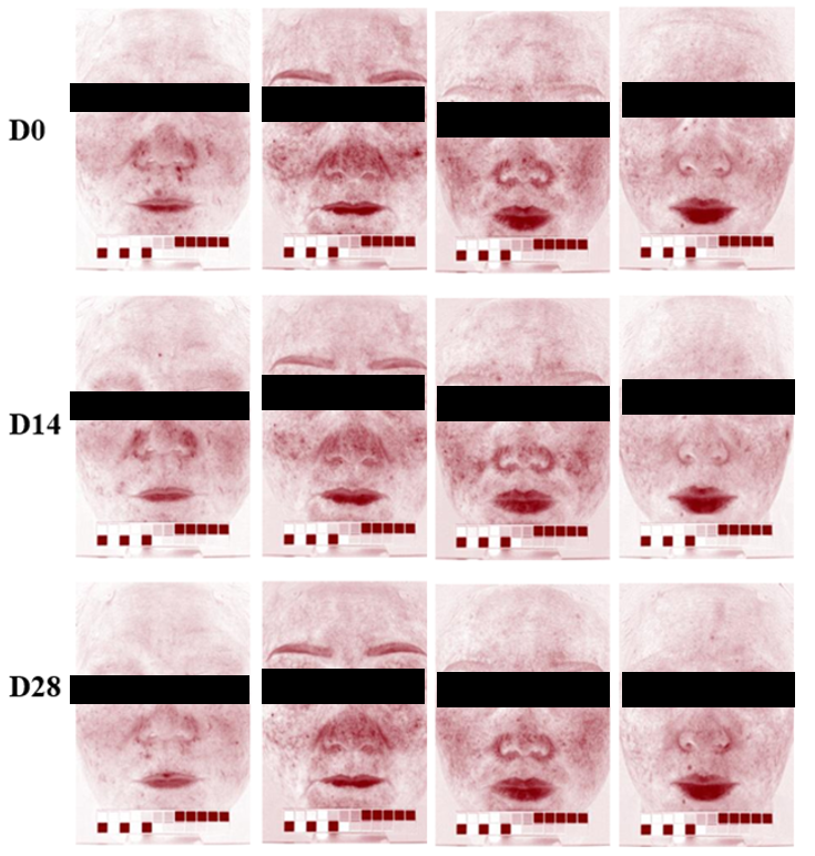 功效評價(jià),新指標(biāo),皮膚表面,脂質(zhì)分析