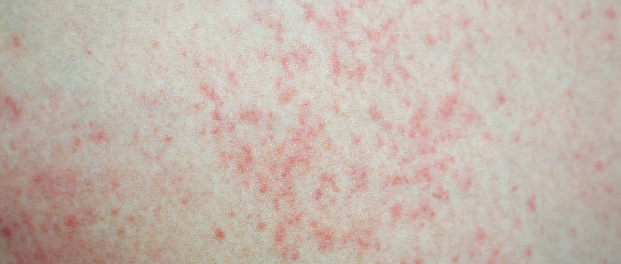 情緒護膚,心理學,情緒評估,科學工具