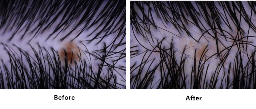 Scalp,health,Cosmetc,Efficacy,Evaluation