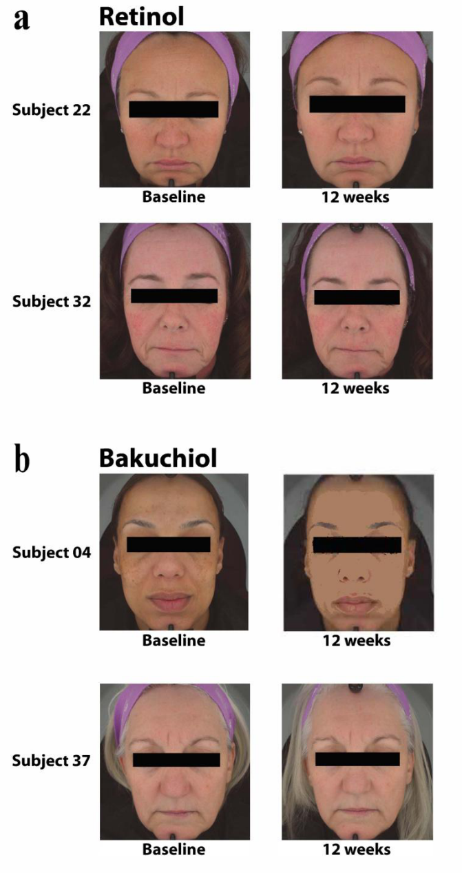 補骨脂酚,抗衰,視黃醇,修復皮膚